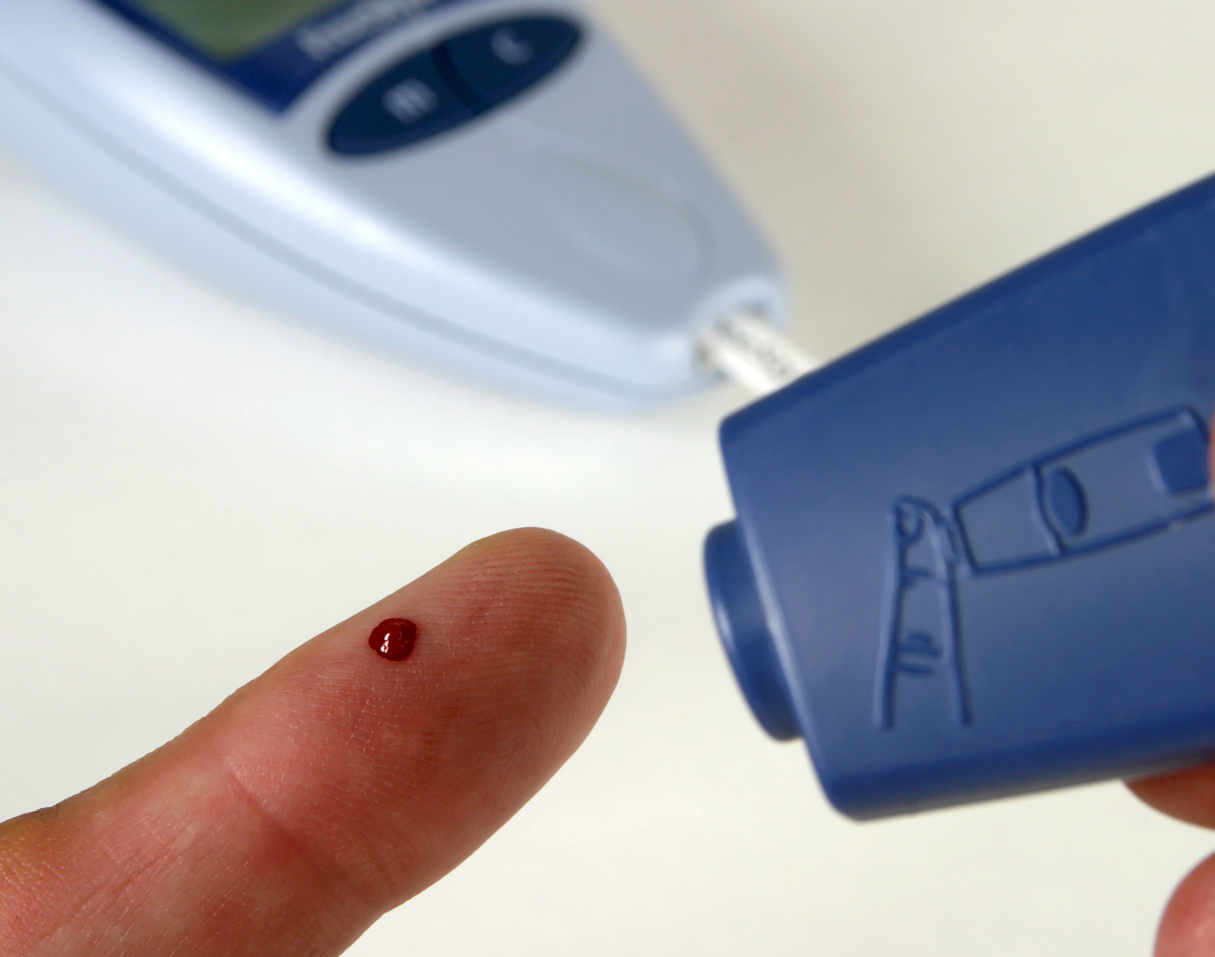 Lo que puede pasar al desarrollar diabetes tipo 2
