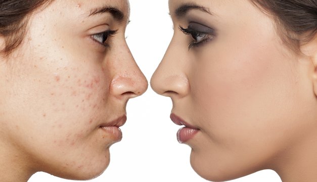 3 manchas en el rostro que pueden afectar tu vida