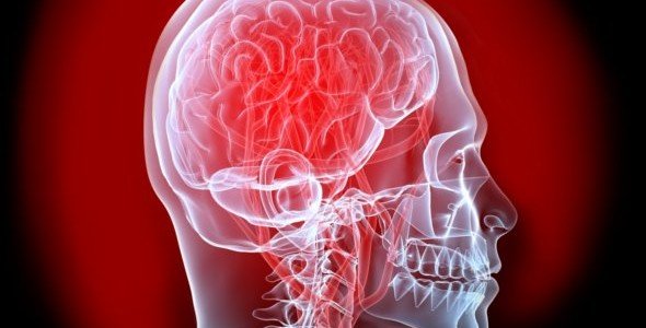 5 señales de alarma de un ataque cerebral