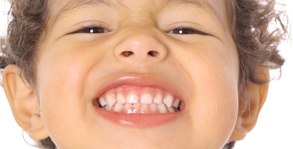 Consejos para la salud bucal de los niños