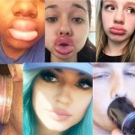 labios deformes