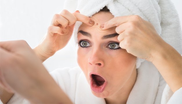 Cura el acné de forma natural