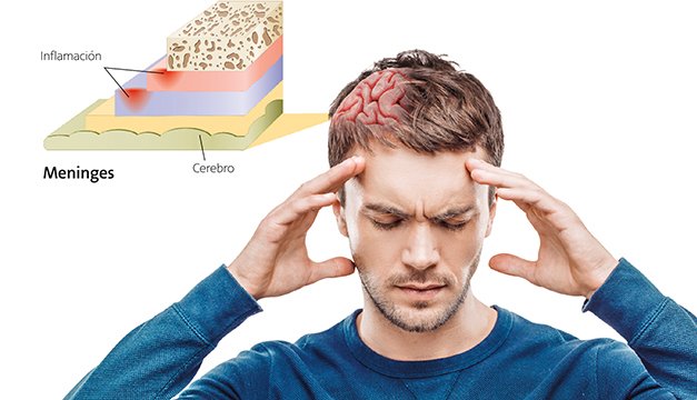 Meningitis bajo lupa