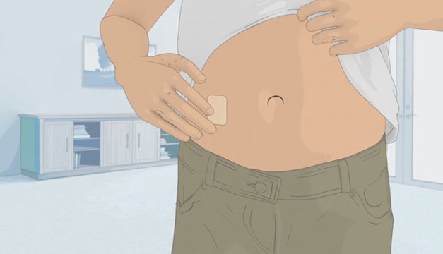 Nuevo parche para el control del Parkinson