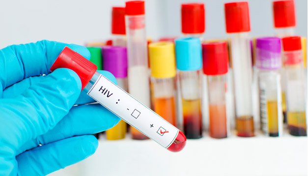 Nuevos componentes en fármacos mejorarían la vida de personas con VIH