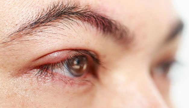 5 remedios naturales para combatir el pispelo