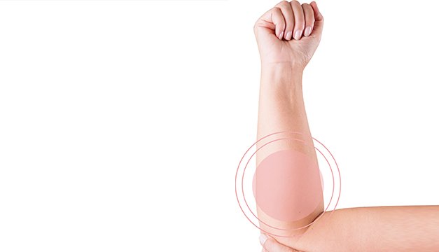 Linfedemas: el problema después de la cirugía