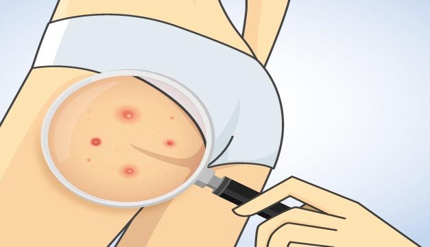 ¿GRANITOS EN EL SUR?