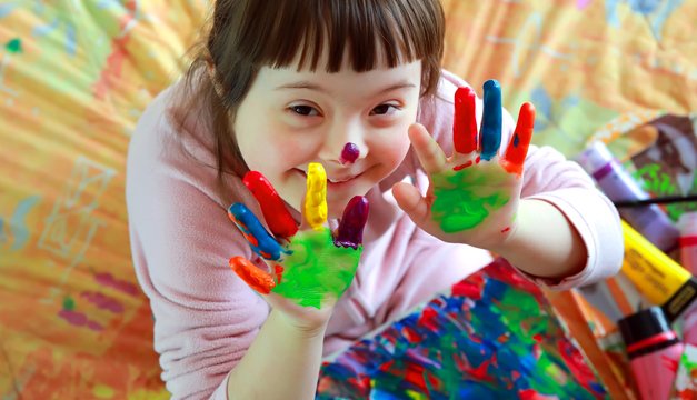 ¿La inclusión escolar de niños con síndrome de down es posible?