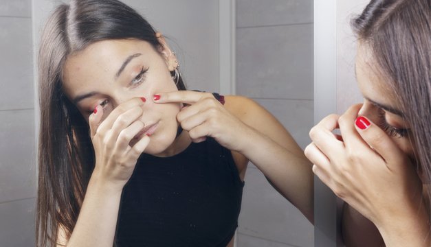 ¿Cómo contrar el acné? Acá la solución