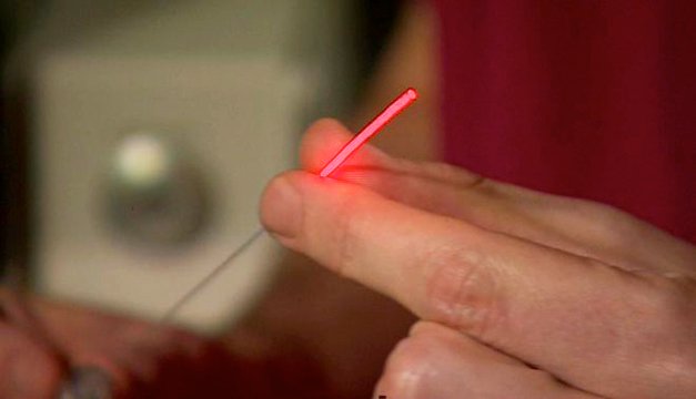 Tratamiento contra el cáncer de próstata que no produce ni impotencia ni incontinencia