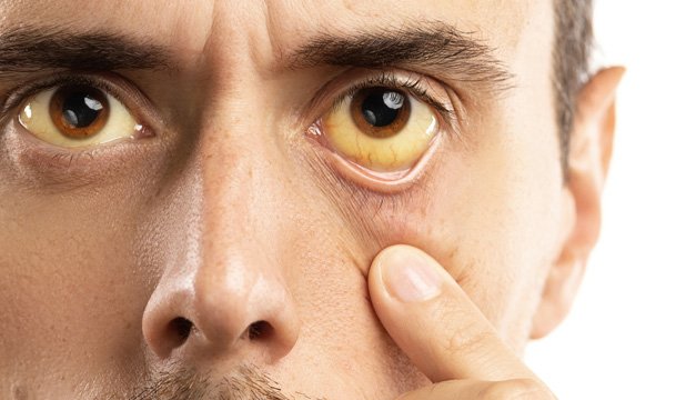 Día Mundial de las Enfermedades Raras ¿qué debes saber?