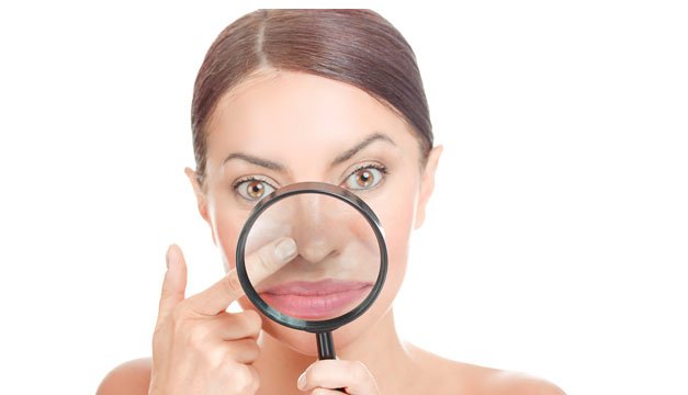 Melasma: ¿por qué salen estas manchas en la cara?