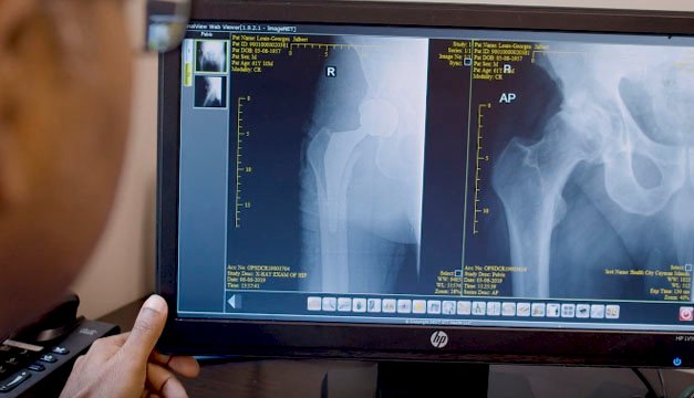 Hondureña vuelve a bailar luego de recibir un reemplazo total de rodilla