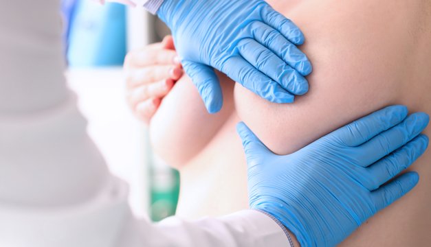 Signos en la piel asociados al cáncer de mama