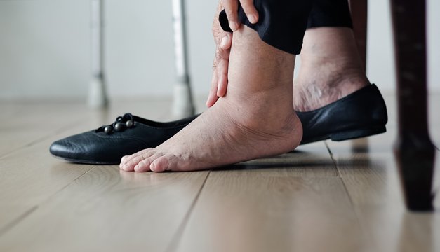 Las personas diabéticas deben cuidar sus pies de los hongos y esta es la razón