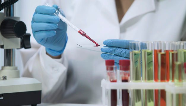 Datos que debes conocer sobre el VIH/SIDA