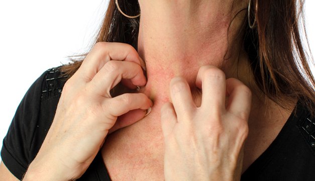 Tipos de alteraciones más frecuentes que afectan la piel