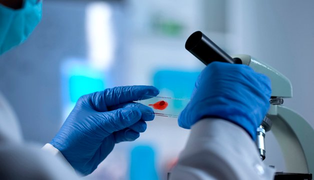 Importante: segundo caso mundial de un paciente curado del sida