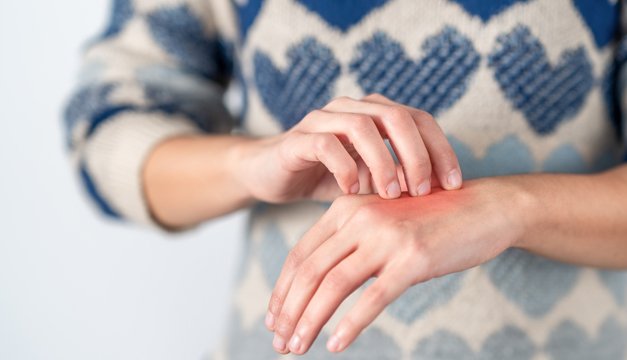 Dermatosis por exceso de videojuegos o dispositivos electrónicos