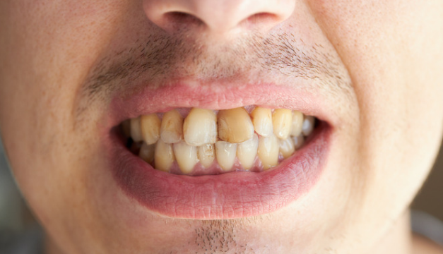 Cuídate de las enfermedades en temporada de lluvia