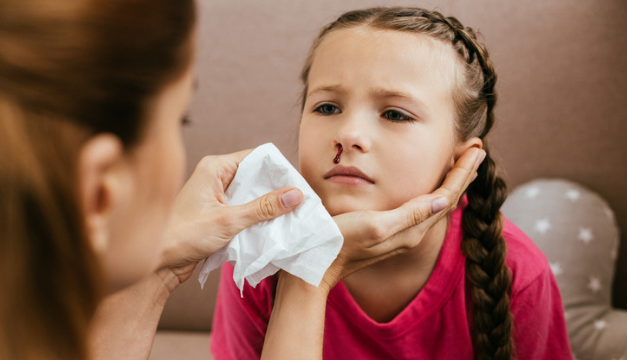 Tuve una hemorragia nasal ¿Debo preocuparme?