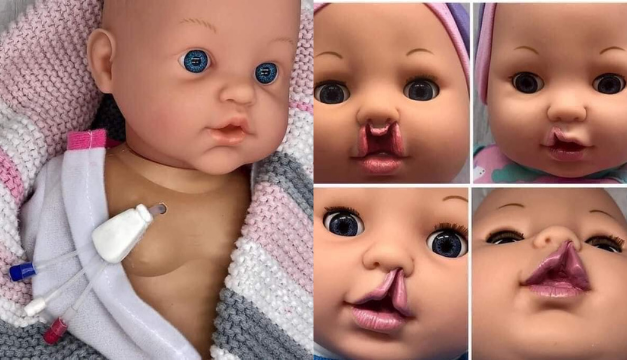 ¿La vacuna del COVID-19 desencadena el síndrome de Guillain-Barré?