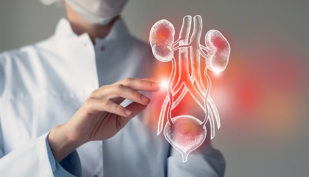 ¿Qué son los cálculos renales?