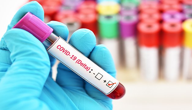 ¿Ya conoces estos datos sobre la variante delta?