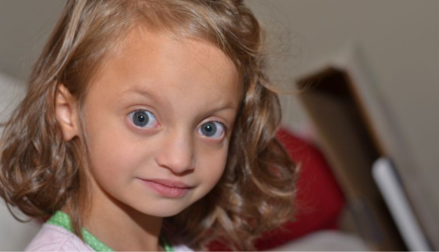 La noticia de una enfermedad rara: Conoce más del Síndrome de Wolf-Hirschhorn