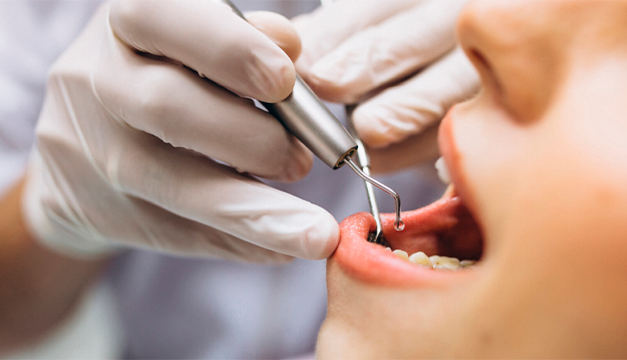 Cuidar la salud oral: es importante practicando estos hábitos de higiene