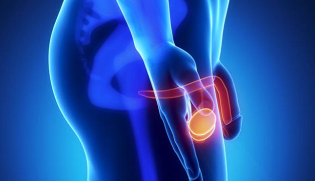 Sabías qué... estas 3 enfermedades pueden afectar a tus testículos