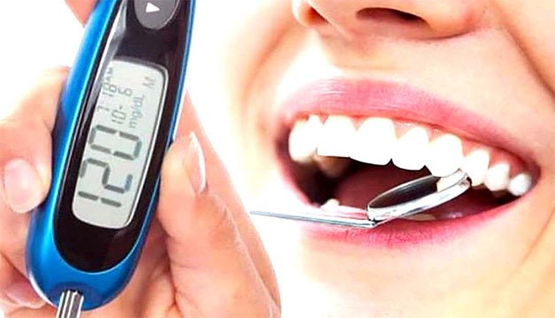 ¿Problemas bucales? Estos podrían indicarte que tienes diabetes