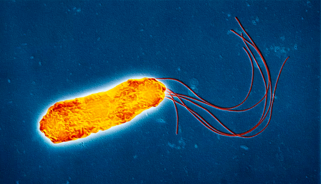 ¿Qué es y cómo se transmite la Melioidiosis?