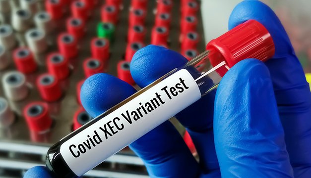 Si tienes estos síntomas respiratorios podría ser XEC la nueva variante covid-19