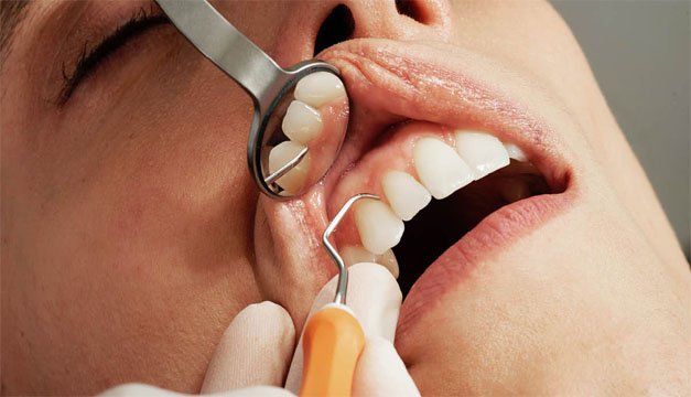 Tienes problemas bucales, estos podrían indicar que padeces de diabetes