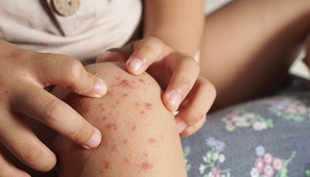 ¿Por qué los adolescente requieren una evaluación médica anual de los testículos?