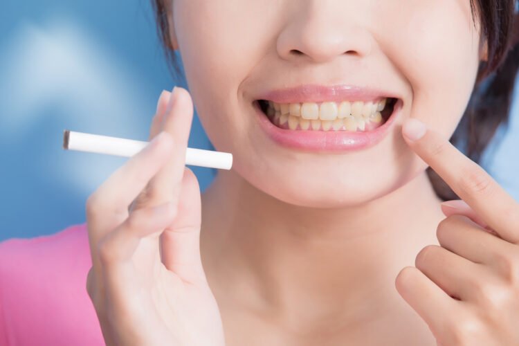 Tabaco: el peor enemigo de tus dientes